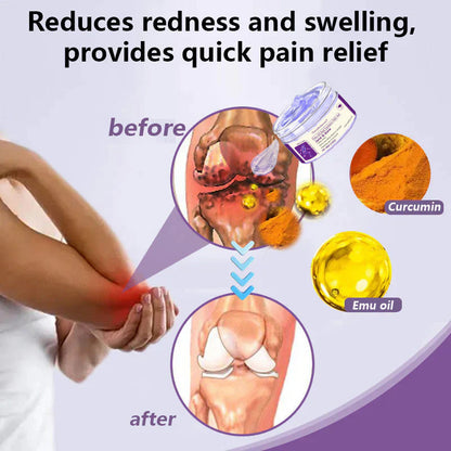 🍀Naturbelassen® Emu Oil And Turmeric Pain Gel👨‍⚕️  TGA Approved 💥