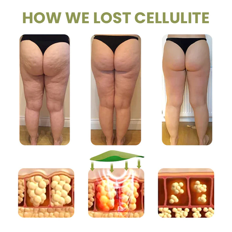SiluForm® Targeted Fat-Burning Adhesive Pads🎉Limited Time Offer🎉