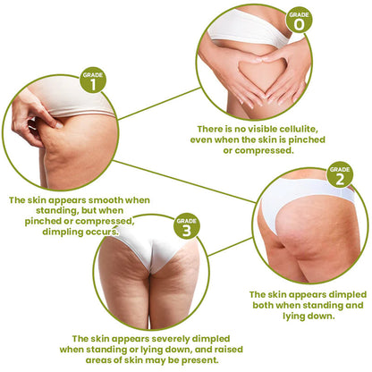 SiluForm® Targeted Fat-Burning Adhesive Pads🎉Limited Time Offer