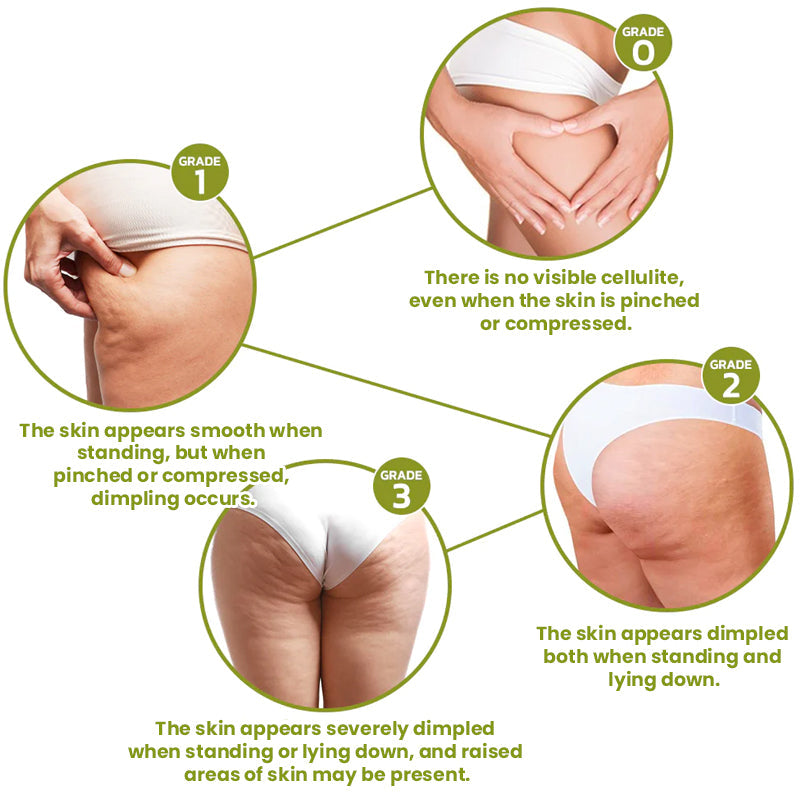 SiluForm® Targeted Fat-Burning Adhesive Pads🎉Limited Time Offer🎉